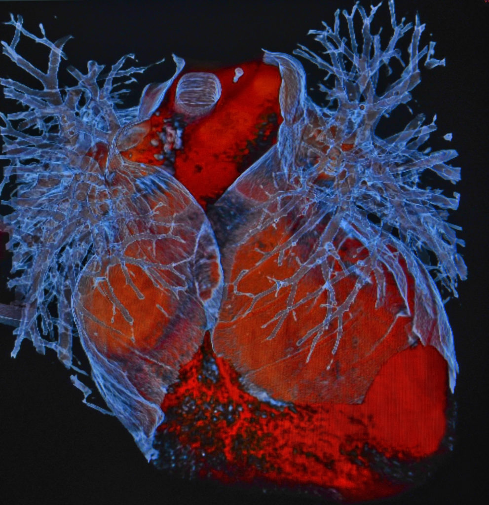 Colorized three-dimensional cardiac diagnostic image