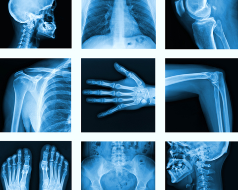 A selection of digital X-ray images